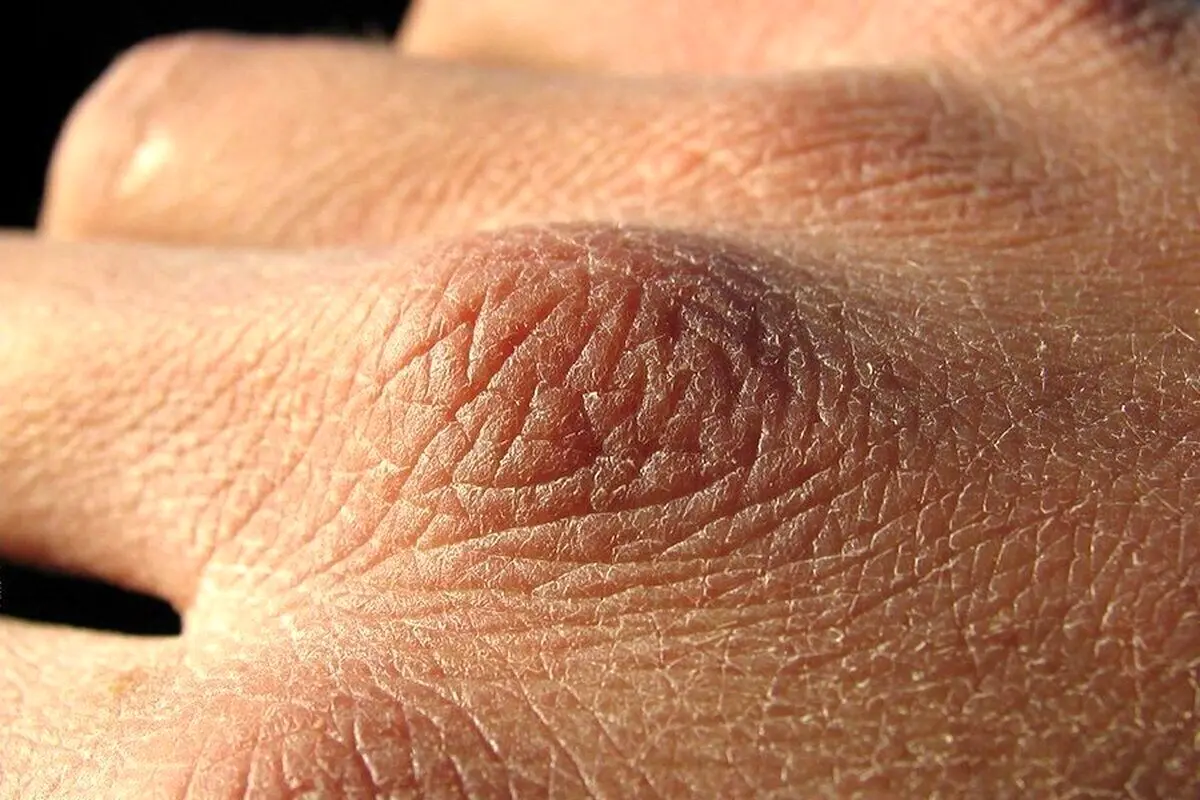 چرا بدن در پاییز تشنه‌تر است؟ | بهترین راهکار برای درمان کم آبی بدن چیست؟
