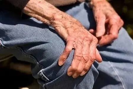 پای مرغ معجزه مفاصل نیست!