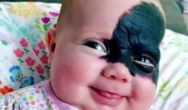 صورت این دختر تا جوانی کاملا تغییر می کند 
