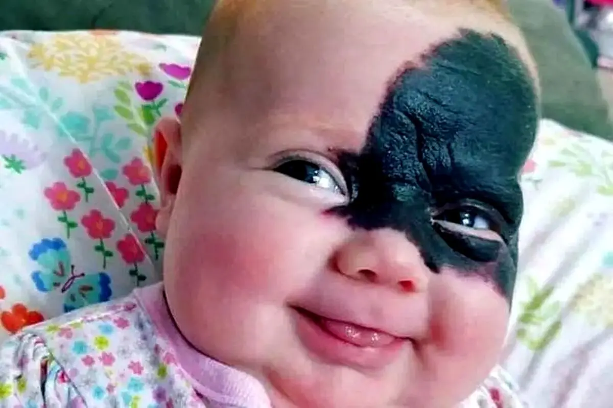 صورت این دختر تا جوانی کاملا تغییر می کند 
