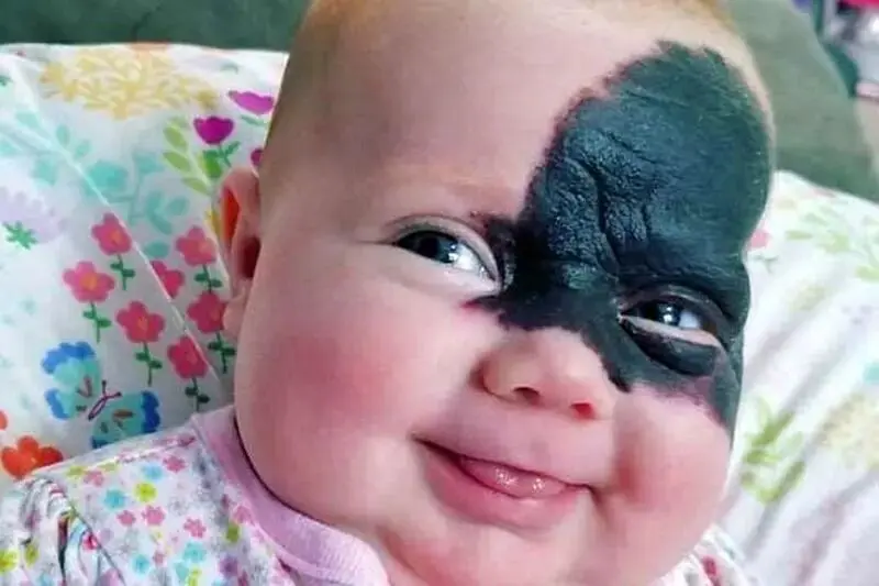 صورت این دختر تا جوانی کاملا تغییر می کند 
