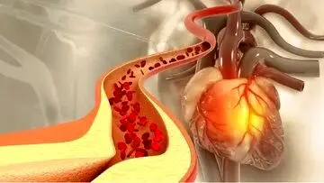 اگر کلسترول خون دارید این ادویه را بخورید
