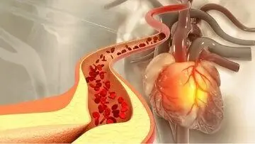 اگر کلسترول خون دارید این ادویه را بخورید