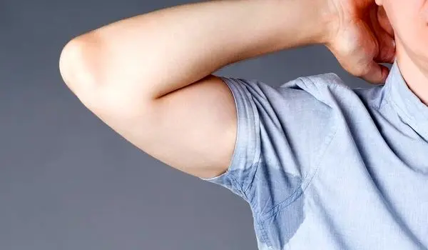 بوتاکس زیربغل چه فایده‌ای دارد؟