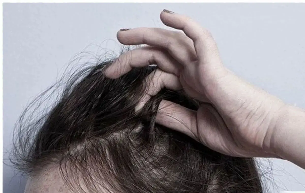 موهای خود را بی‌دلیل از دست می‌دهید؟ | این علت‌ها را تا حالا نشنیده‌اید