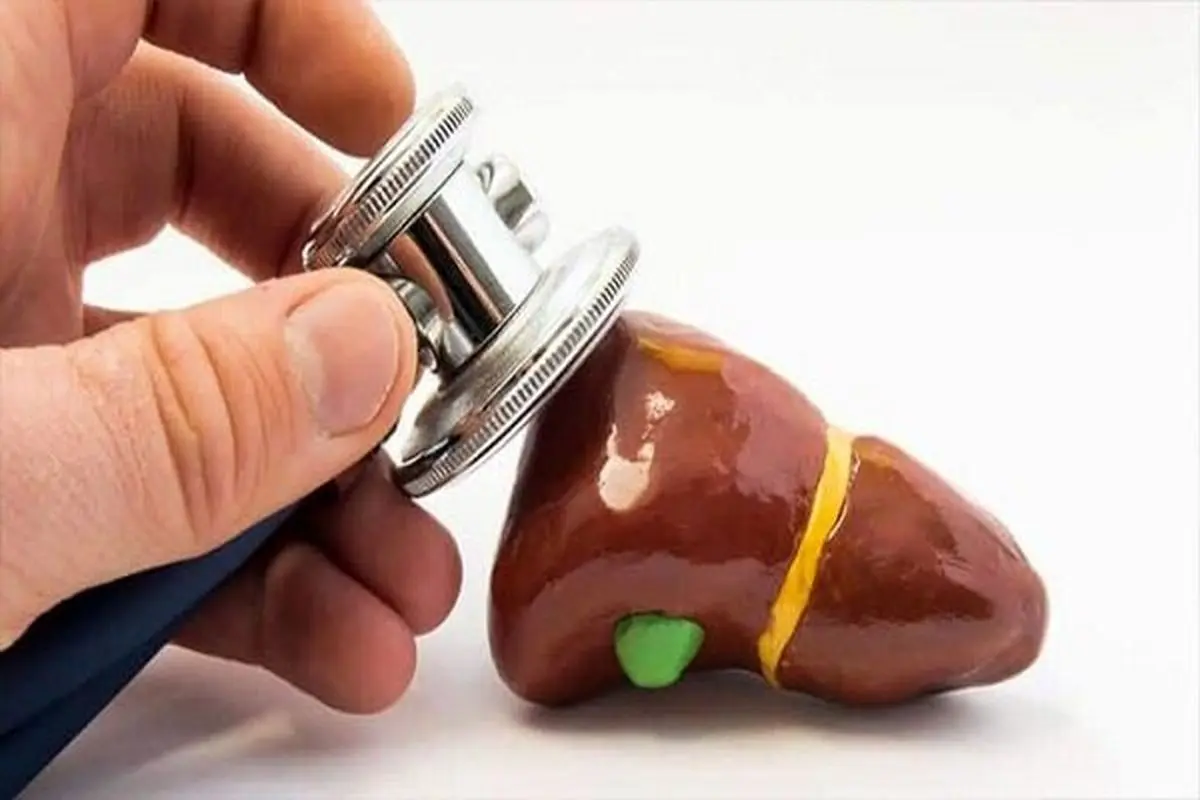 چگونه بفهمیم که سنگ کیسه صفرا داریم؟