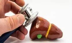 چگونه بفهمیم که سنگ کیسه صفرا داریم؟