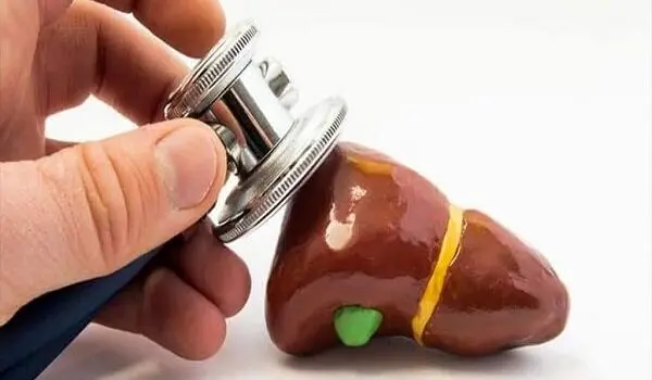 چگونه بفهمیم که سنگ کیسه صفرا داریم؟