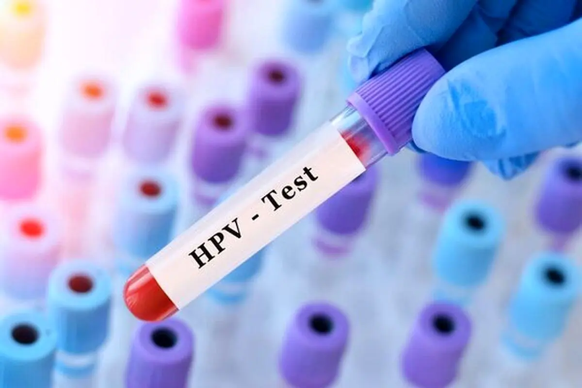 همه چیز درباره تشخیصHPV و هزینه درمان زگیل تناسلی+ جدول