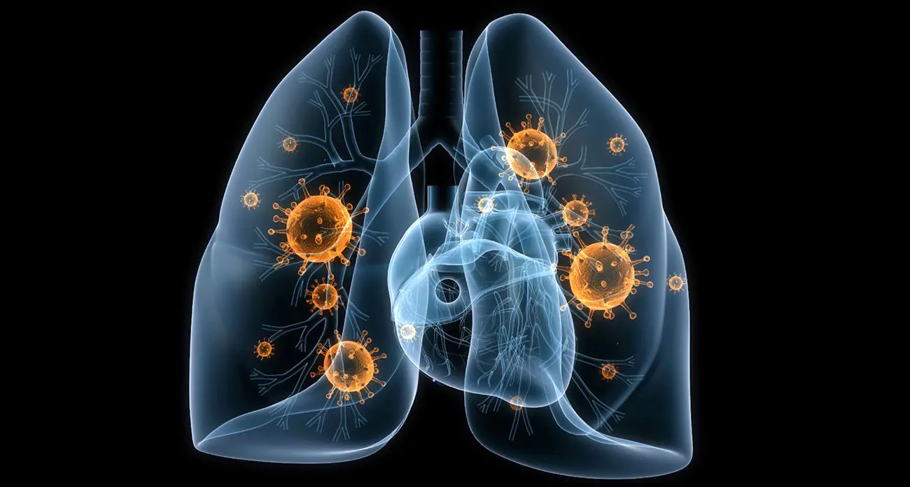 با پیک عفونت‌های تنفسی مواجه نیستیم