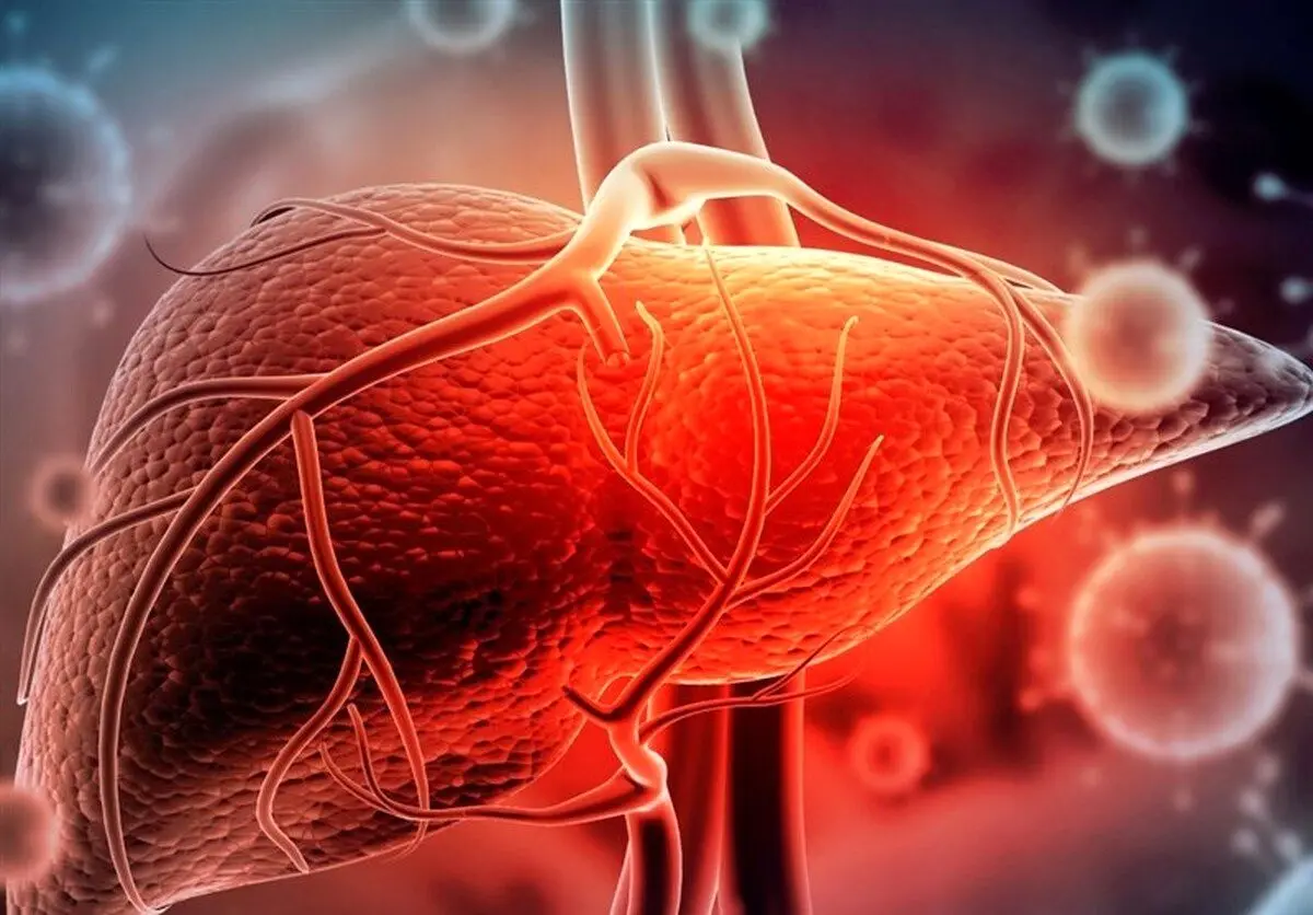 کدام علائم کبد چرب در چهره نمایان می‌شوند؟
