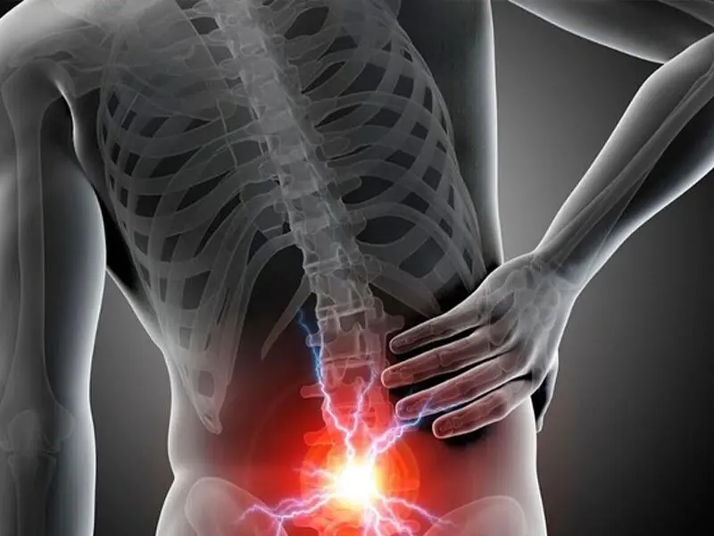 چه کنیم تا دچار گرفتگی عضلات کمر نشویم؟