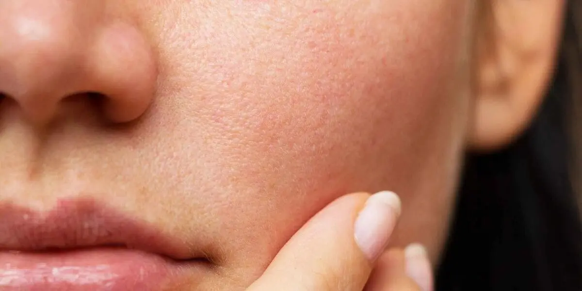 ۱۰ توصیه برای مراقبت از پوست خشک در پاییز
