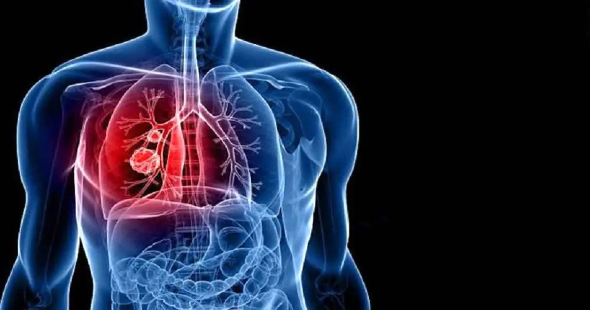 برای تقویت سیستم ایمنی بدن چه نکاتی را باید رعایت کنیم؟