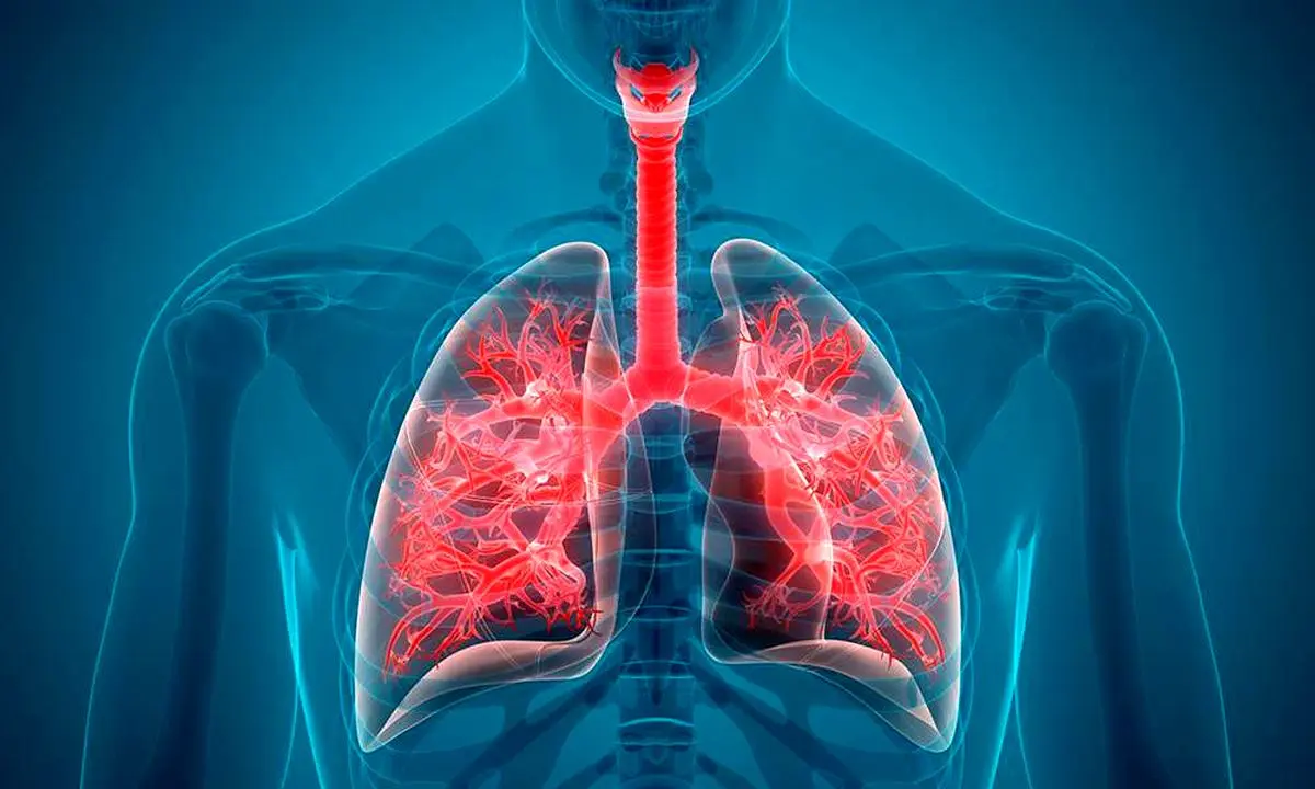 ۵ روش برای افزایش ایمنی ریه ها