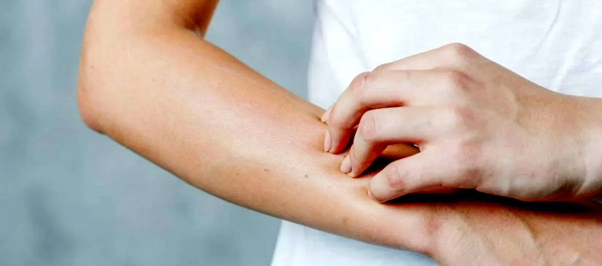 چند توصیه برای کاهش خشکی پوست