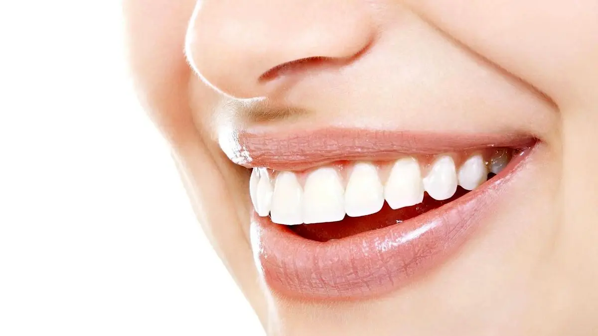 10 نکته که چگونه لبخند جذاب تری داشته باشیم!