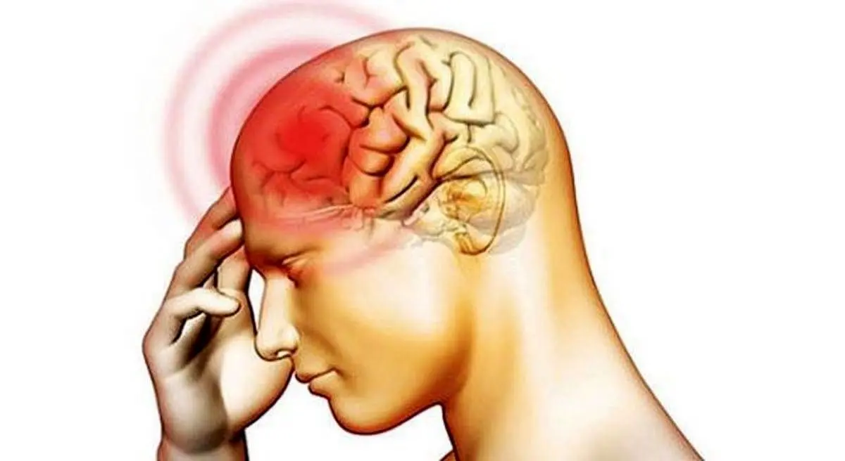 همهچیز درباره «مننژیت»