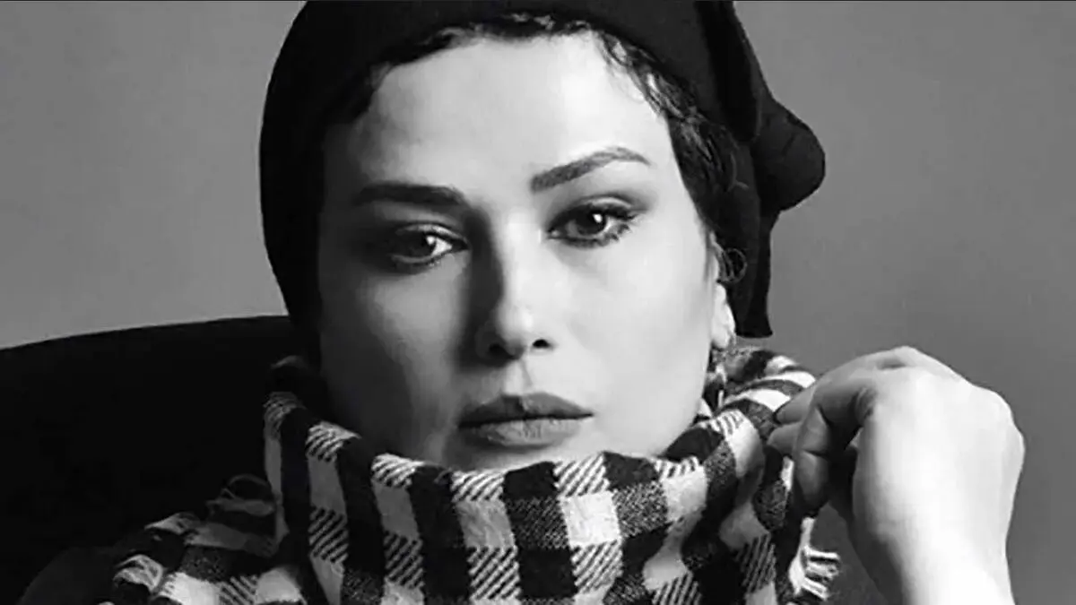 تغییر چهره خانم بازیگر همه را شوکه کرد