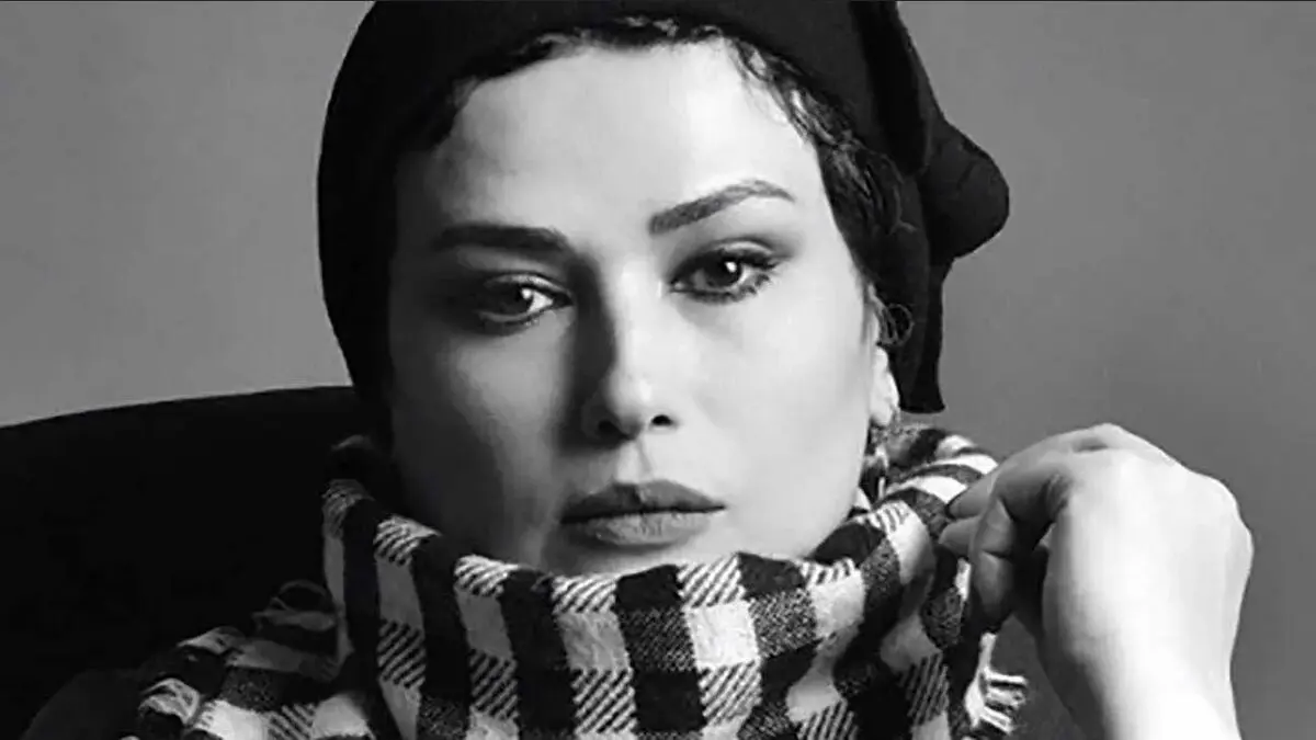 تغییر چهره خانم بازیگر همه را شوکه کرد