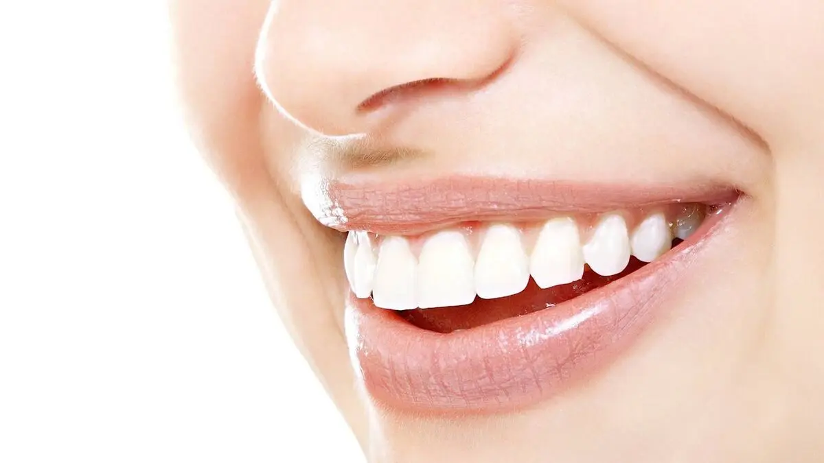 راهکارهایی برای سفید کردن دندان ها + اینفوگرافی