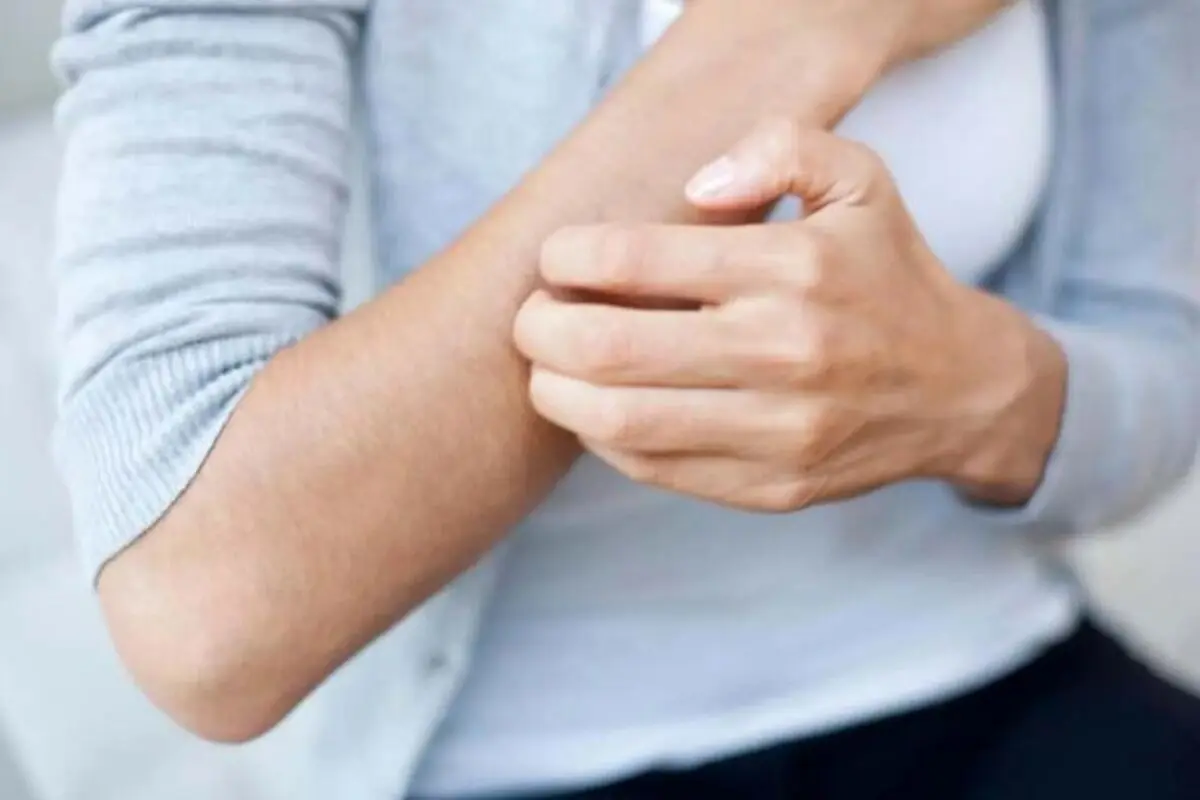این علائم را در بدن جدی بگیرید؛ درچه شرایطی بعد از گزیدگی باید به پزشک مراجعه کرد؟