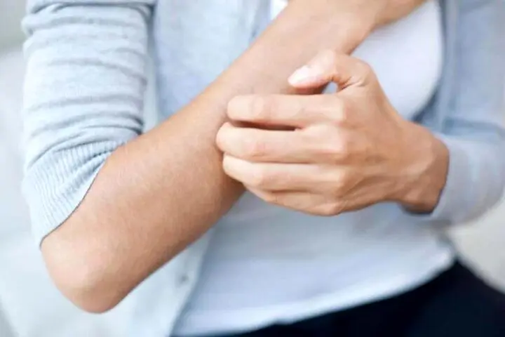این علائم را در بدن جدی بگیرید؛ درچه شرایطی بعد از گزیدگی باید به پزشک مراجعه کرد؟
