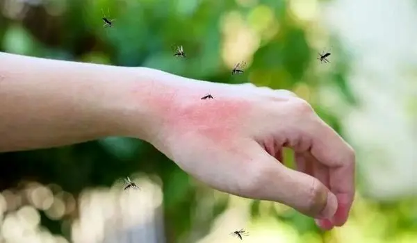 چرا پشه‌ها سراغ همه آدم‌ها نمی‌روند؟ | برای پشه‌ها مردان محبوب‌تر هستند یا زنان؟