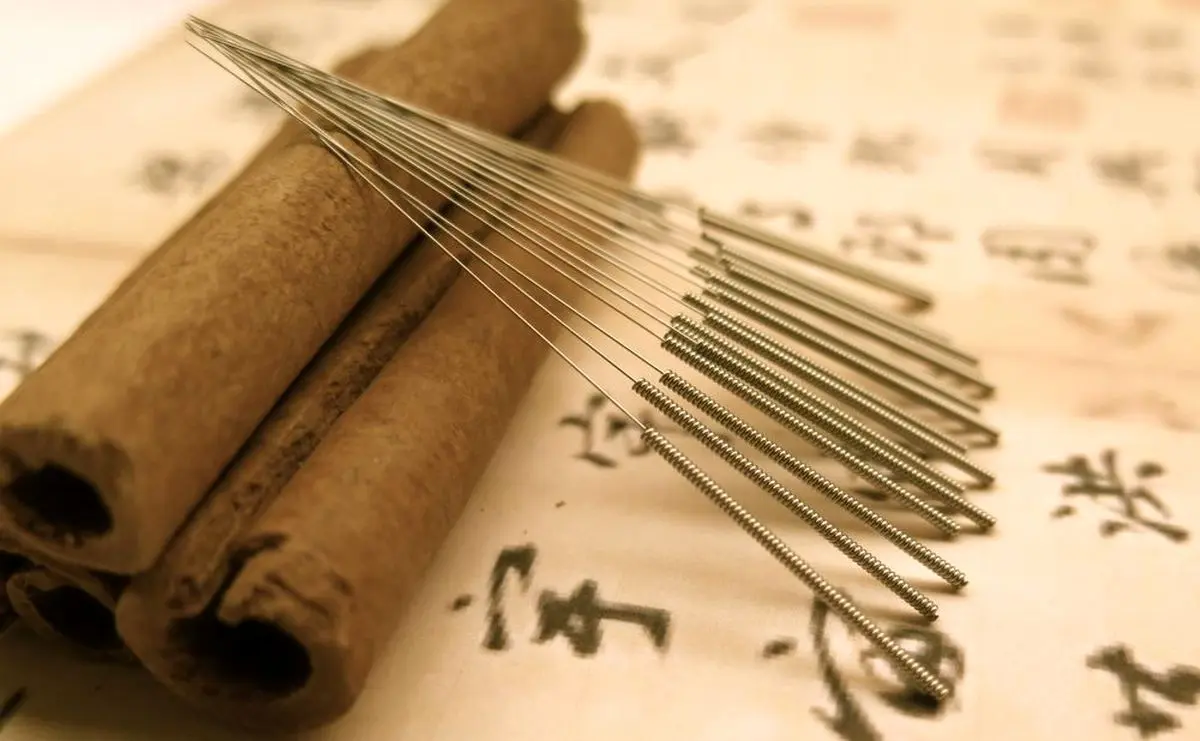 دردهایی که با طب سوزنی درمان می شوند | رسانه خبری اینتیتر | طب سوزنی