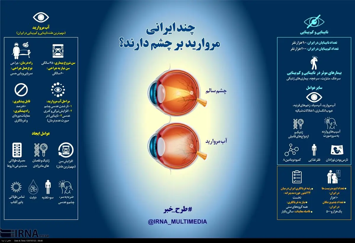 چند ایرانی مروارید برچشم دارند؟ + اینفوگرافی