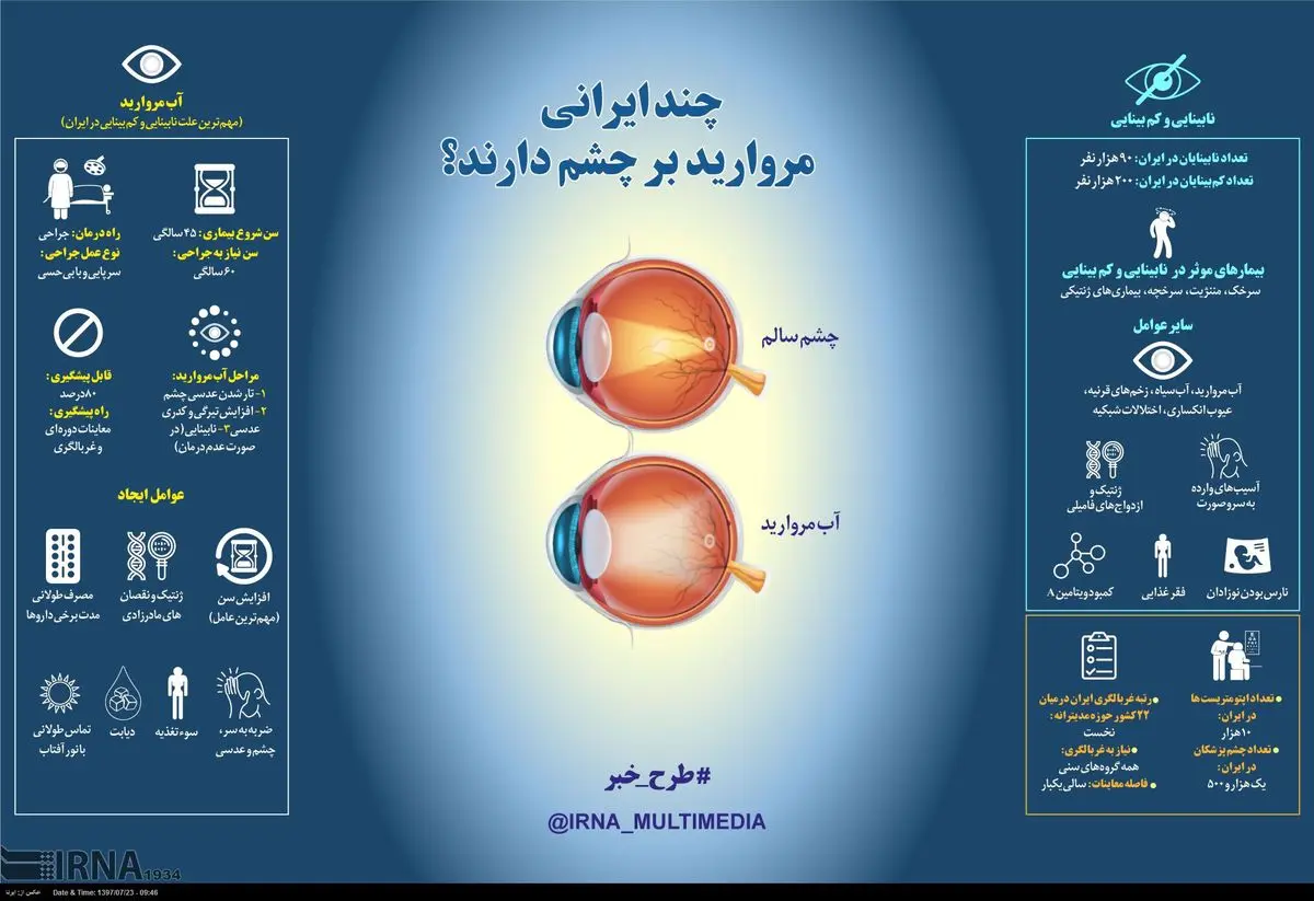 چند ایرانی مروارید برچشم دارند؟ + اینفوگرافی