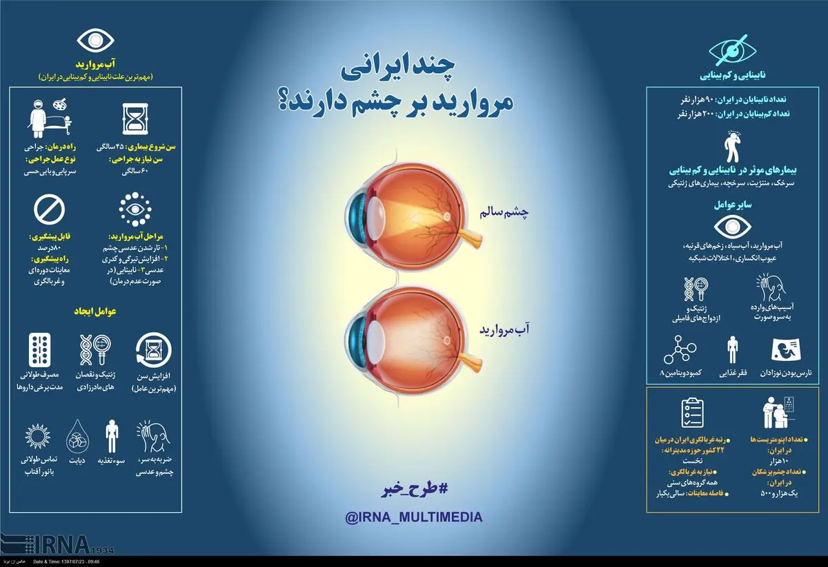 چند ایرانی مروارید برچشم دارند؟ + اینفوگرافی