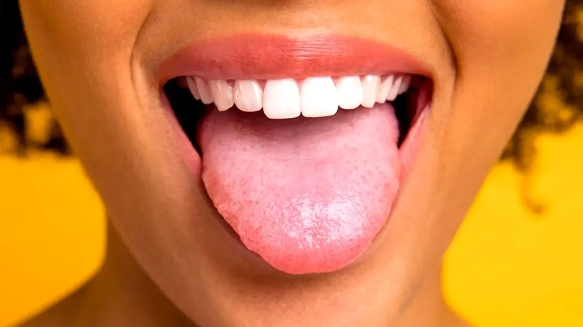 تغییر رنگ زبان این بیماری خطرناک را لو می‌دهد