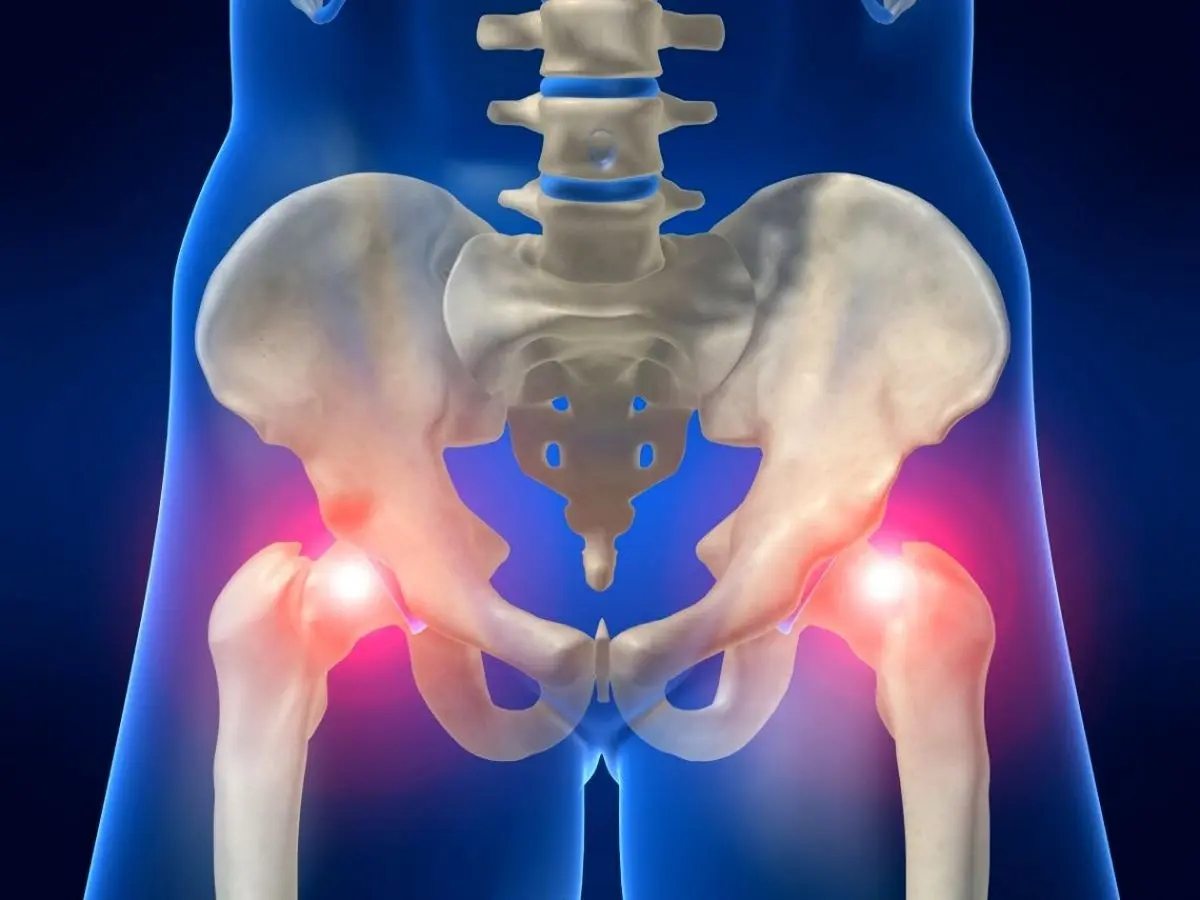 معرفی چند ورزش‌ عالی برای درمان آرتروز لگن