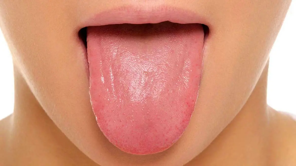 چگونه خشکی دهان را درمان کنیم؟