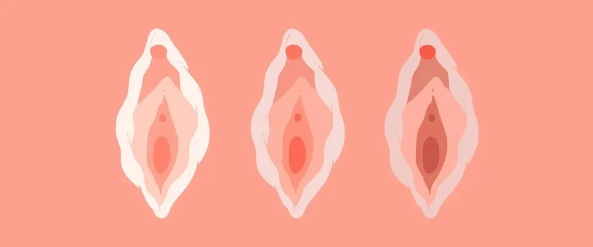 علت تورم لبهای کوچک واژن؛ درمان التهاب و خشکی واژن