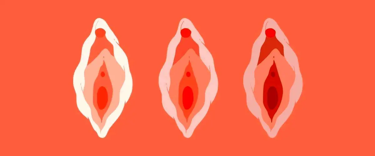 علت تورم لبهای کوچک واژن؛ درمان التهاب و خشکی واژن