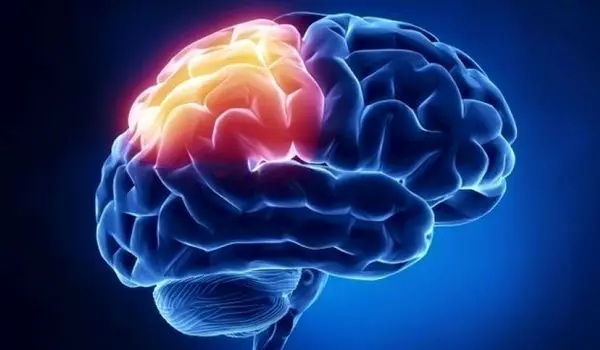 علائم باورنکردنی نوعی سرطان مغز