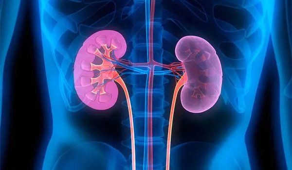 دشمنان کلیه را بشناسید