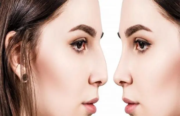 عمل بینی نیمه فانتزی؛ چگونه طبیعی و جذاب را ترکیب کنیم؟