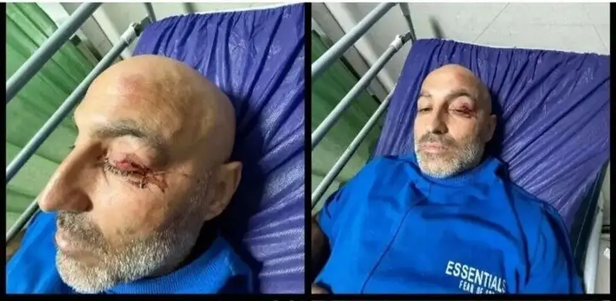 بستری شدن ستاره سابق استقلال بعد از تصادف شدید