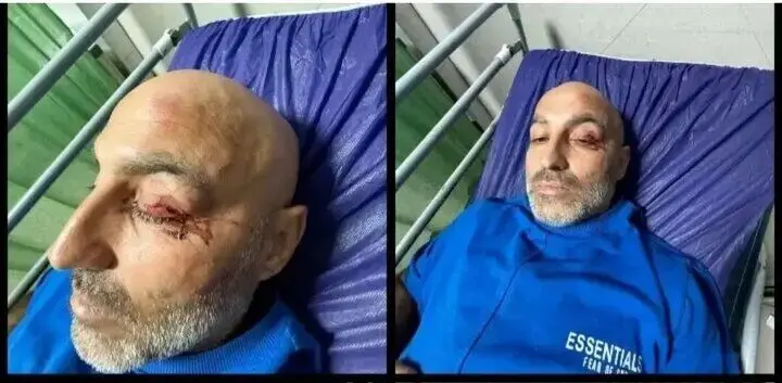 بستری شدن ستاره سابق استقلال بعد از تصادف شدید