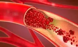 روش‌های اورژانسی پیشگیری از خونریزی در مجروحان
