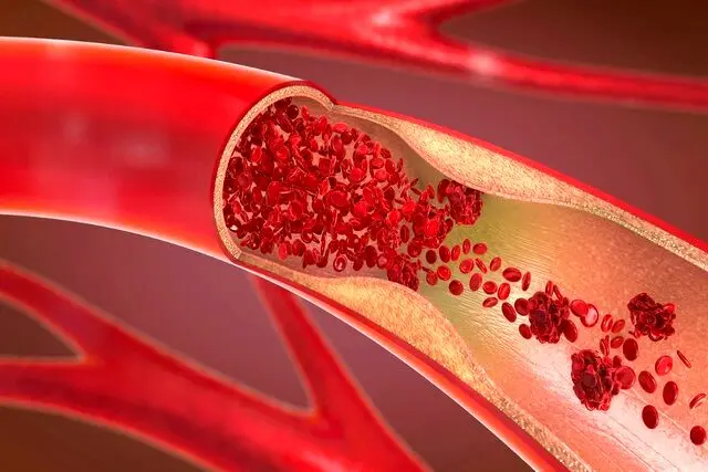 روش‌های اورژانسی پیشگیری از خونریزی در مجروحان
