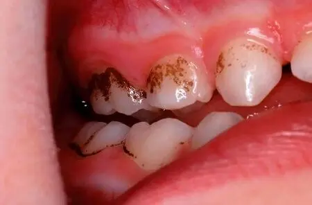 برای سلامت دندان ها اینها را بخور
