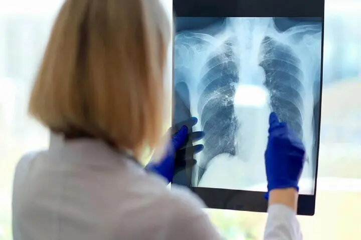 یک علت مهم و کمتر گفته شده درباره خستگی مزمن