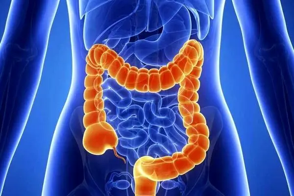 خوردن این غذا‌ها ریسک ابتلا به سرطان روده را بالا می‌برد