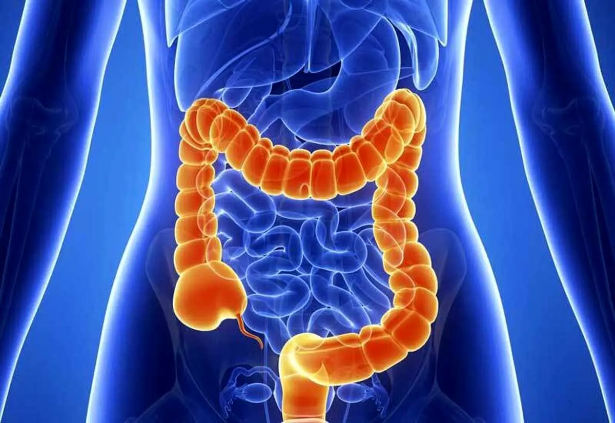 خوردن این غذا‌ها ریسک ابتلا به سرطان روده را بالا می‌برد