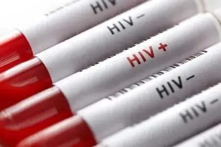 راه‌های انتقال ایدز؛ از پیشگیری تا درمان | تفاوت HIV با ایدز چیست؟