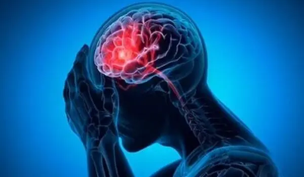 ارتباط میگرن با یک عارضه خطرناک در میانسالی